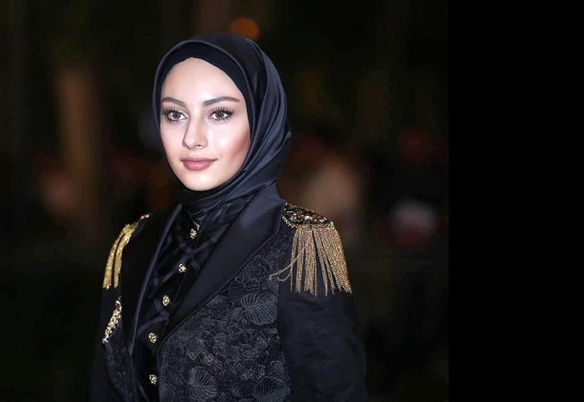 چهره جدید ترلان پروانه بعد از تزریق ژل | استایل اروپایی ترلان پروانه در کافه